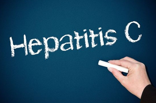 Hepatitis C – the DAA era